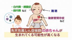 写真：akachanijyo　先天性風しん症候群の赤ちゃんが生まれてくる可能性が高くなる