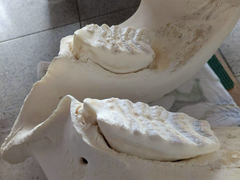 ふじ子の歯の写真